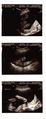 20150625-ultrasound-01.jpg
