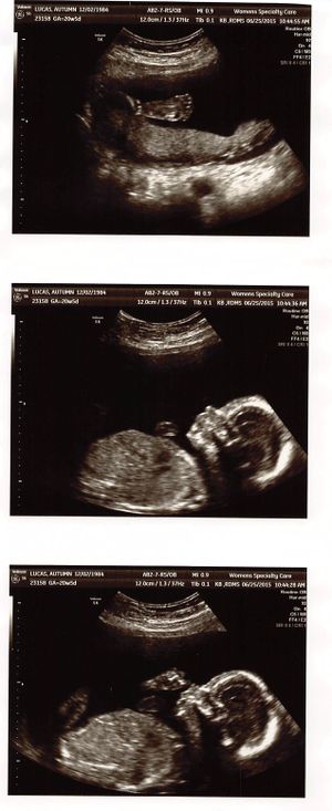 20150625-ultrasound-02.jpg