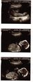 20150625-ultrasound-02.jpg